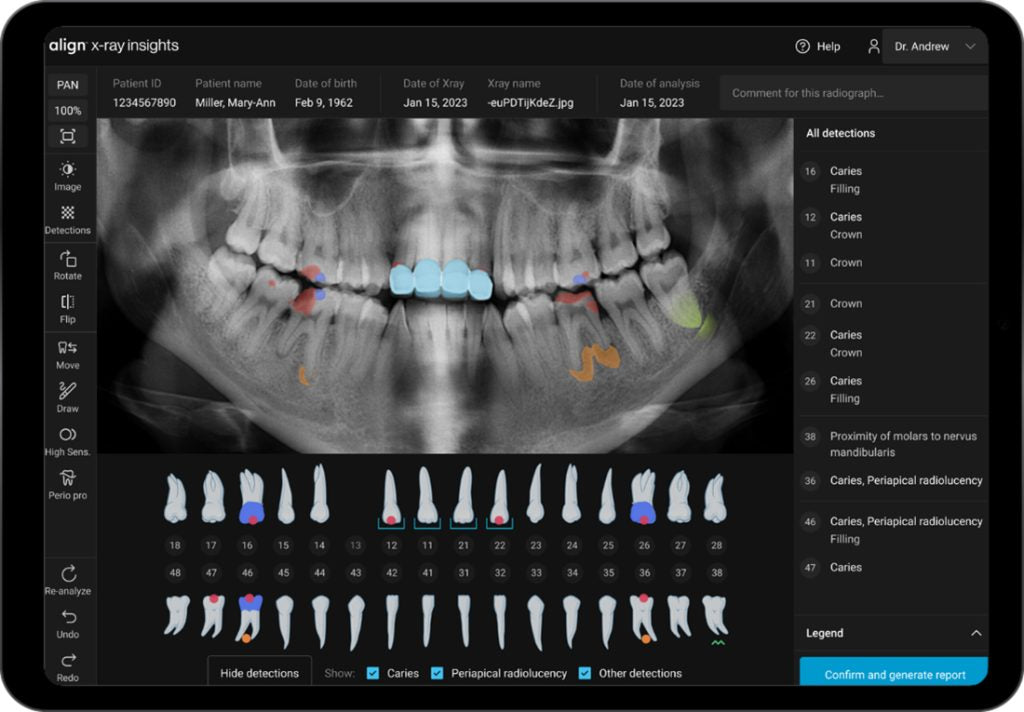 3D graphic of a mouth with bruxism awaiting to be traeted at NYC dental clinic
