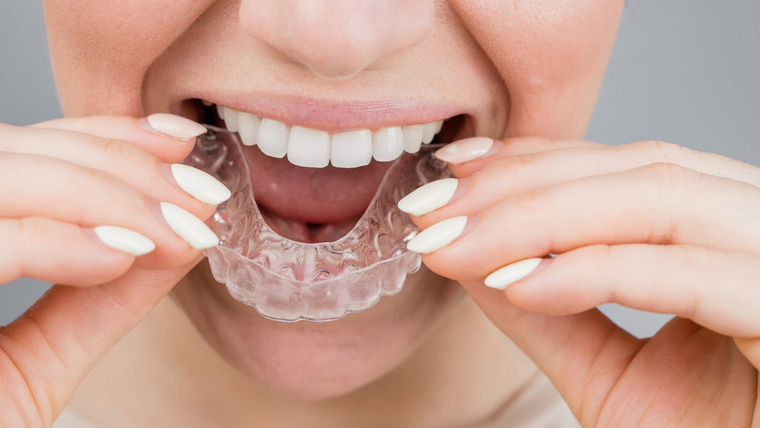 Why Smile Retainers Should Be Worn Daily - Diamond Braces