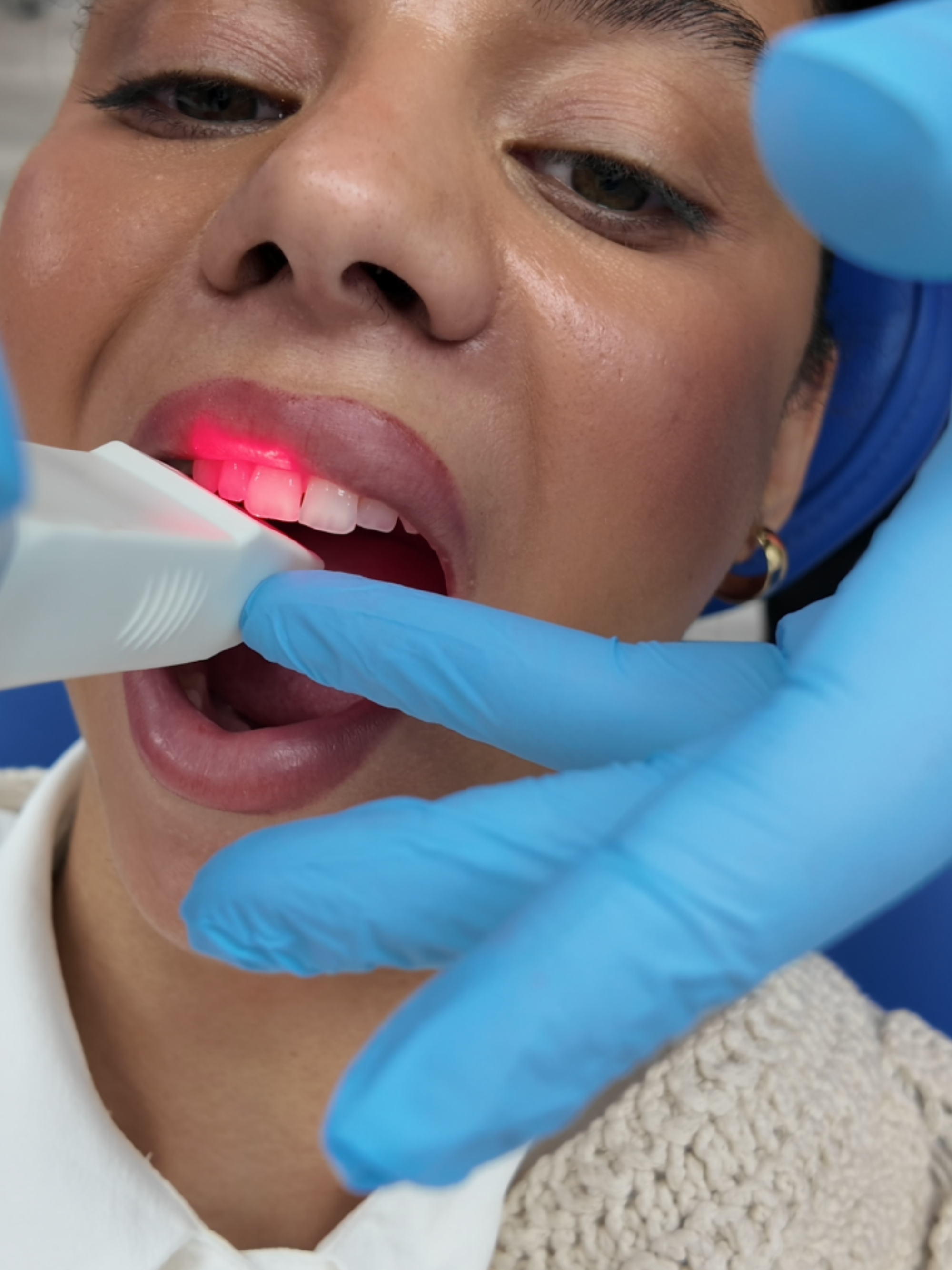 Dental care patient getting her teeth scanned for traditional braces treatment.