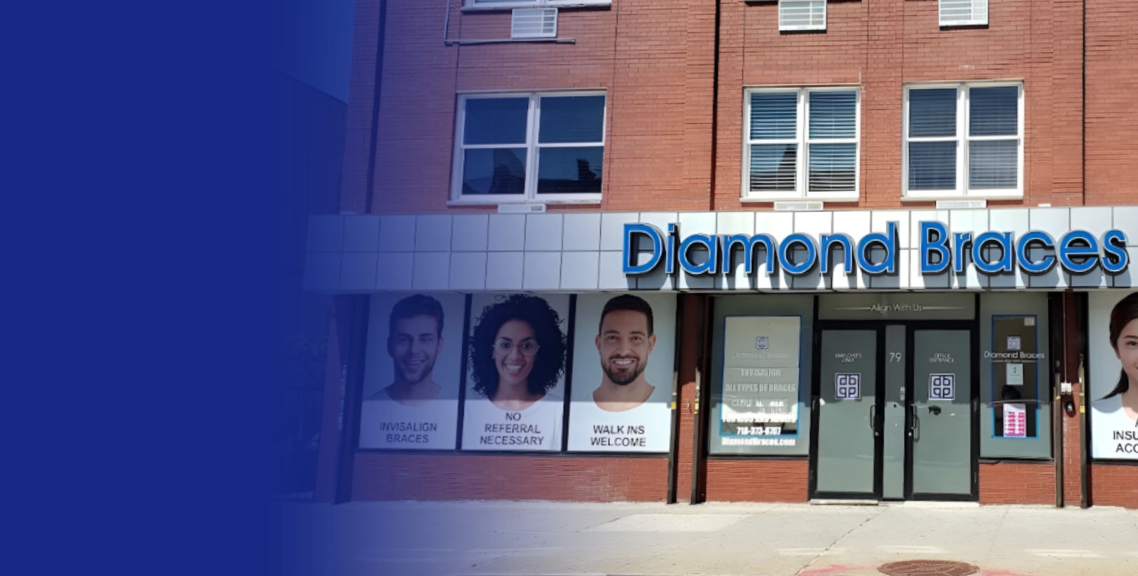 Diamond Braces dental clinic entrance with promotional posters on a brick building for Invisalign and traditional braces.