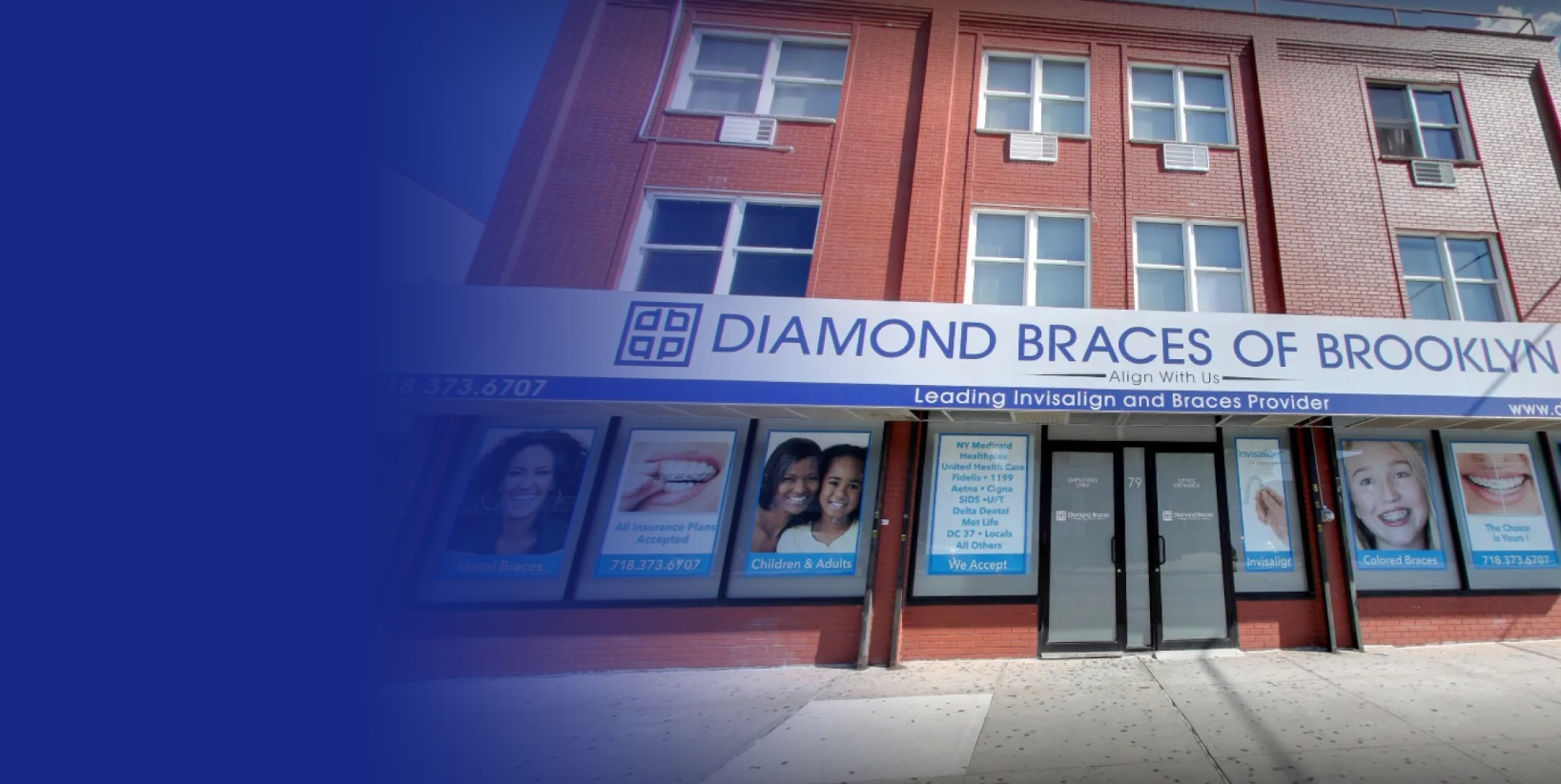 Diamond Braces of Brooklyn dentist office exterior with promotional posters for Invisalign and metal braces on a building facade.