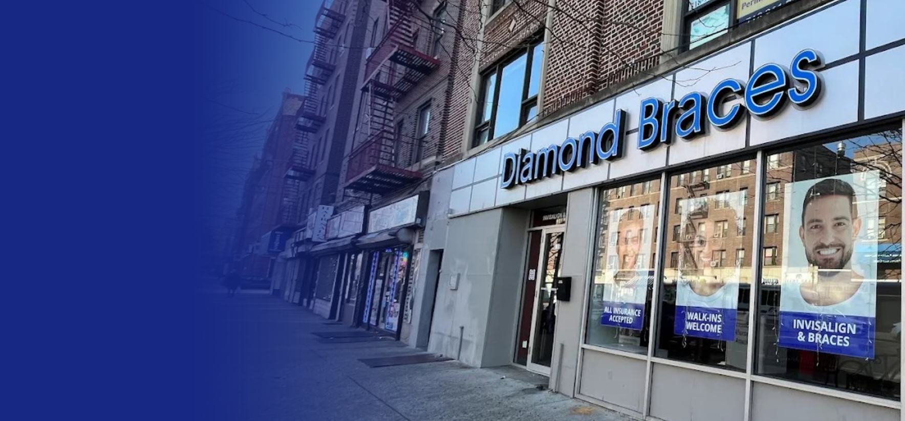 Diamond Braces dental office exterior with large glass windows displaying promotional materials for traditional braces and clear aligners in Brooklyn.