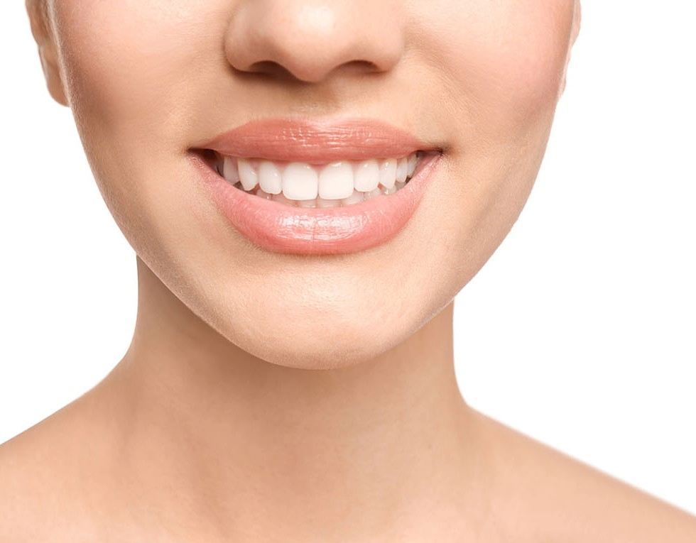 Teeth after braces or invisalign
