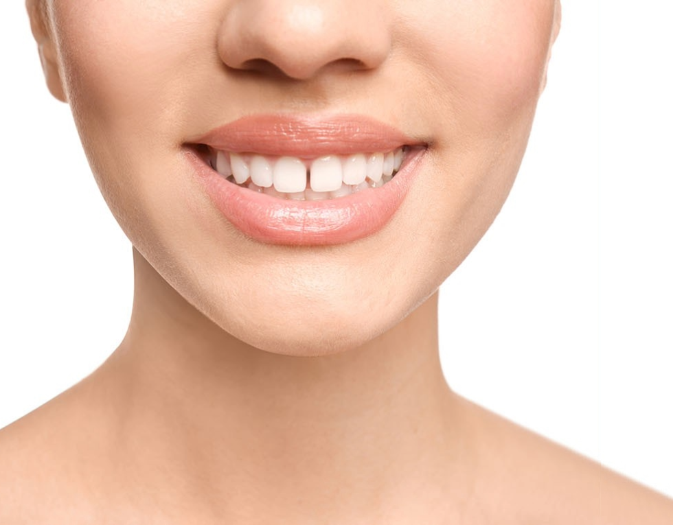 Teeth before Braces or Invisalign