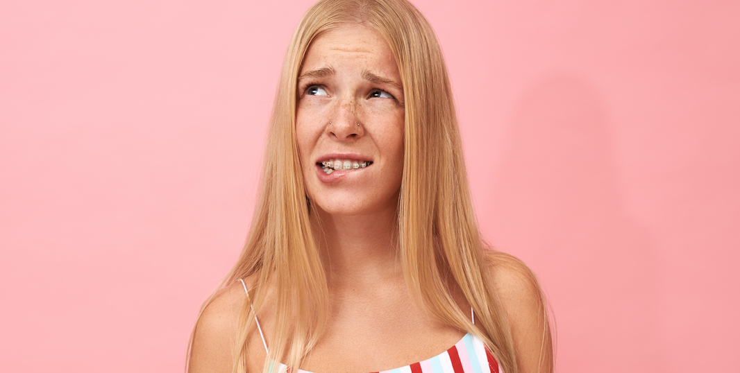 How Long Does It Take to Get Braces On