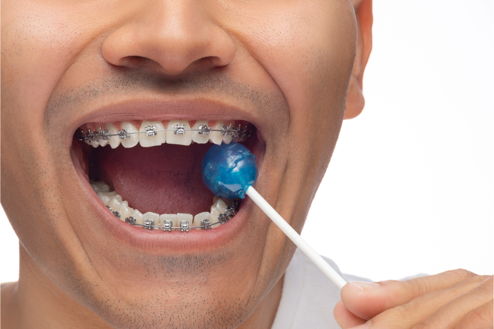 Man Eats Hard Food with Braces and Invisalign
