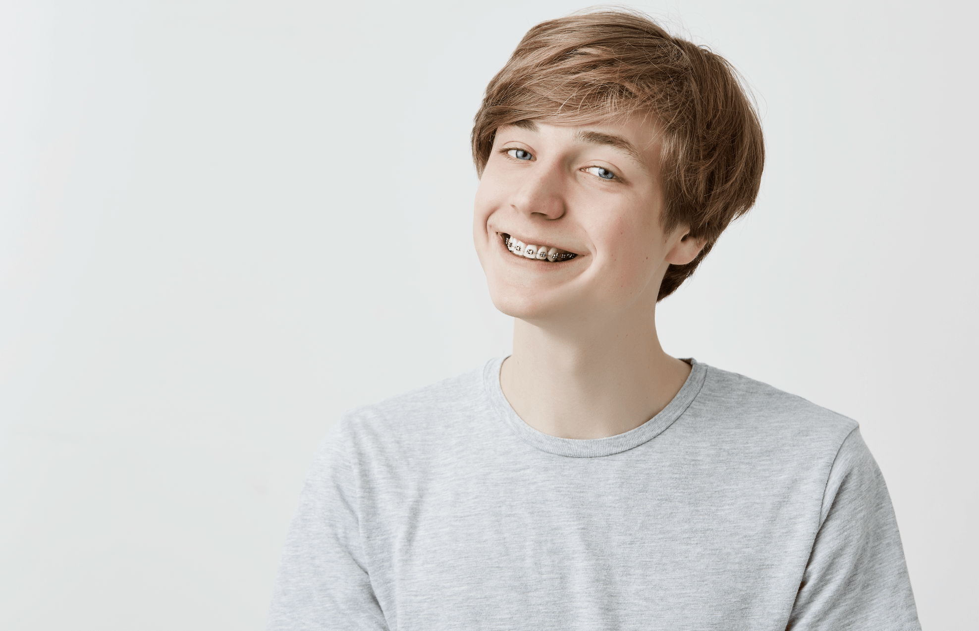 Braces With Wisdom Teeth Coming In: A Patient Guide - Diamond Braces