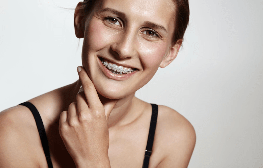 Clear Braces vs Metal Braces: What’s the Difference? - Diamond Braces