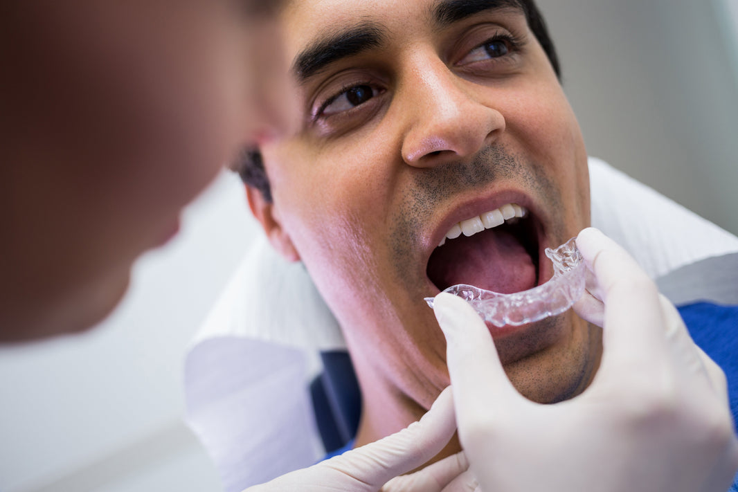 Damon Braces vs Traditional Braces: Key Differences - Diamond Braces