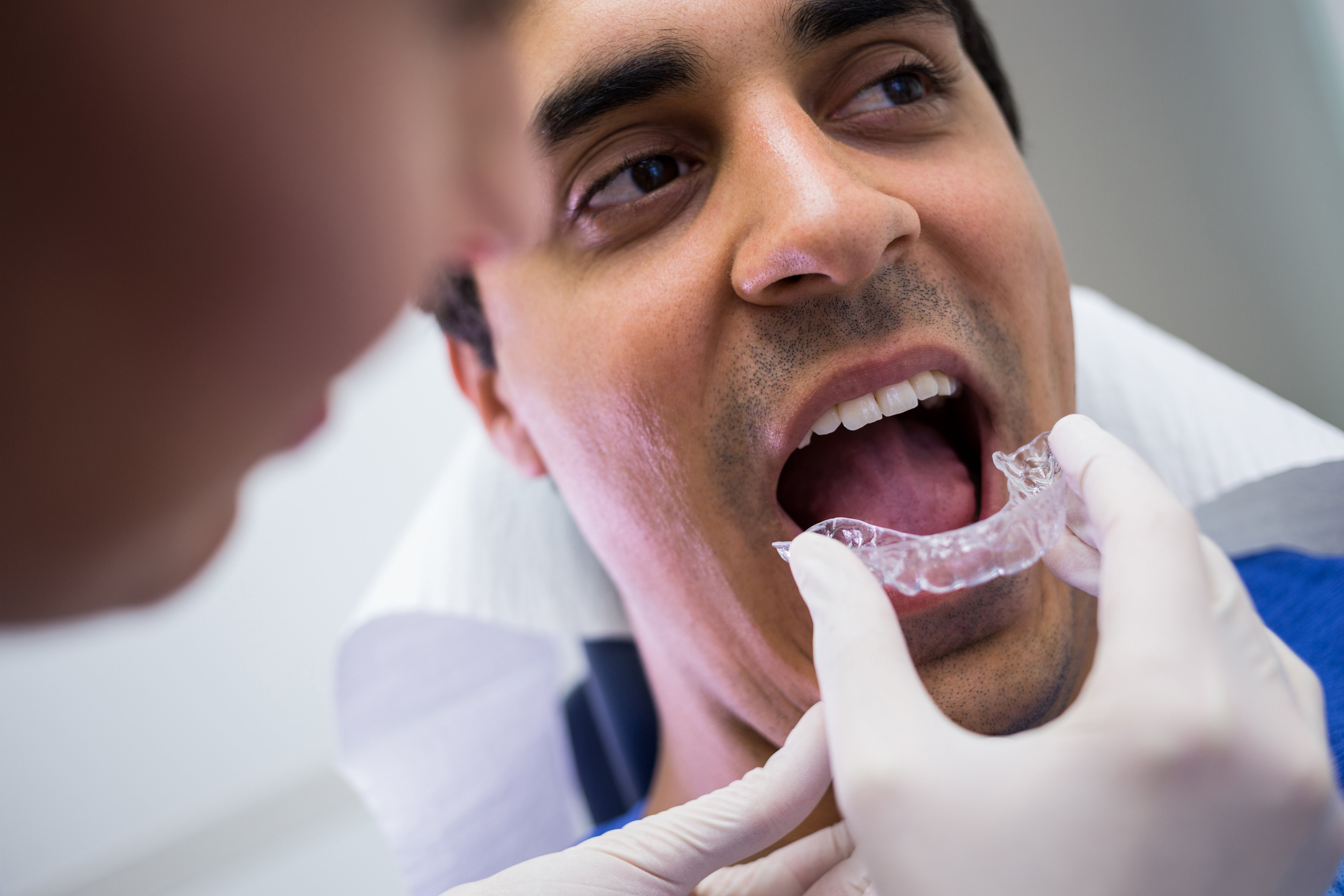 Damon Braces vs Traditional Braces: Key Differences - Diamond Braces