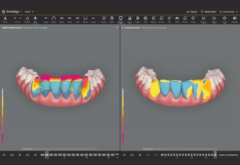 Diamond Braces’ Virtual and Tech Annual Summit - Diamond Braces