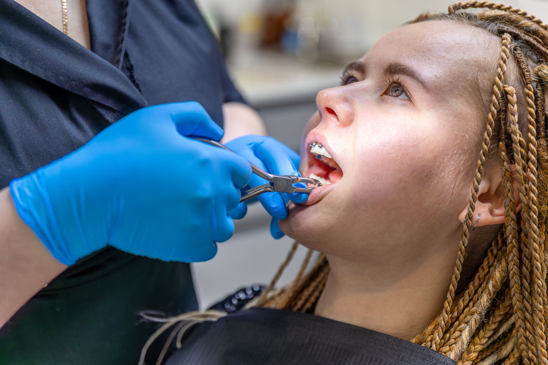 How Long Does Removing Braces Take? What to Expect - Diamond Braces