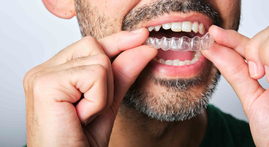 Invisalign Pain and How to Manage Clear Aligner Discomfort - Diamond Braces