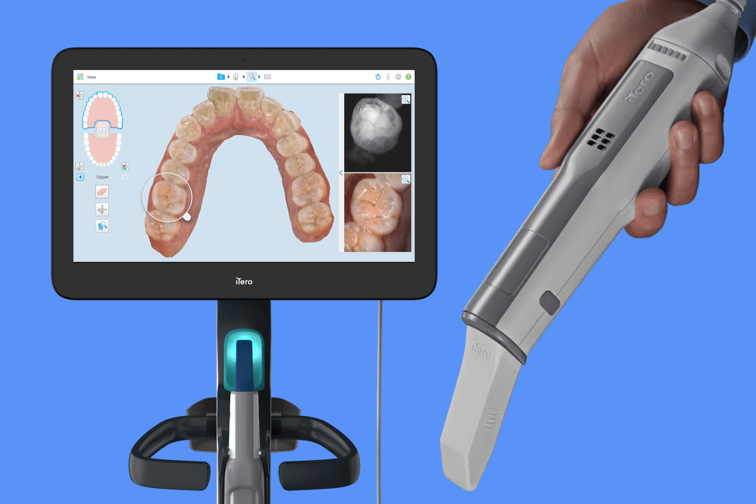 Invisalign iTero Scanners Powers Better Results – Diamond Braces