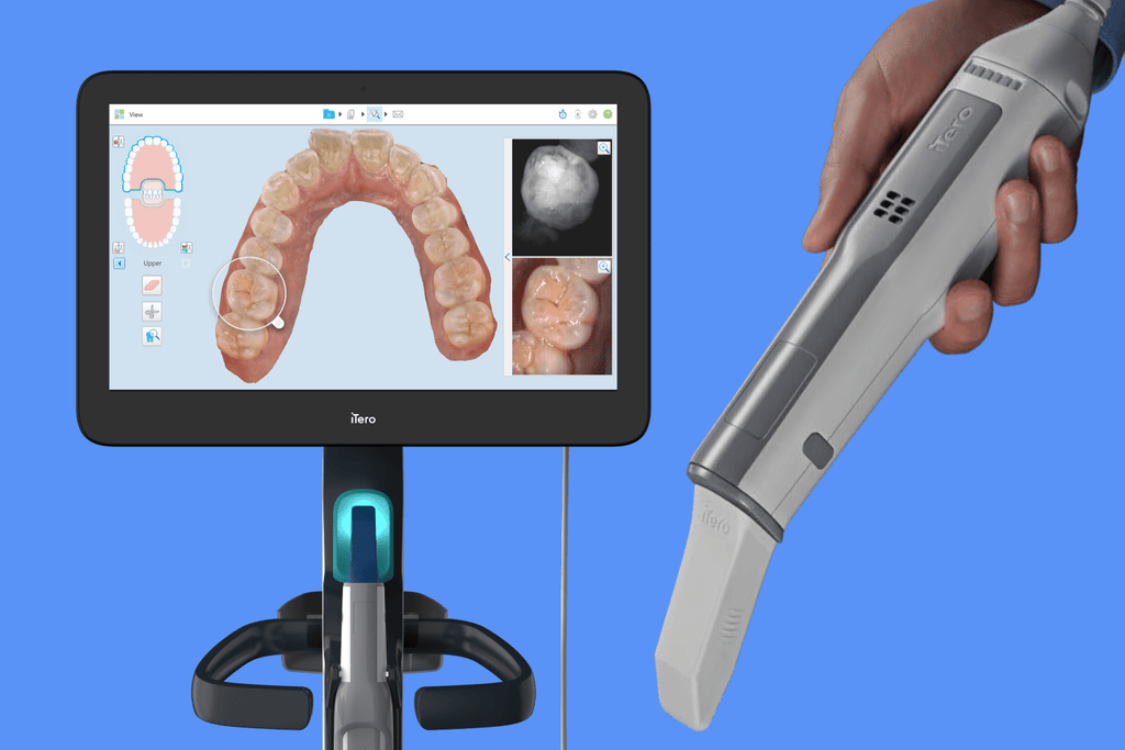 https://www.diamondbraces.com/cdn/shop/articles/itero-element-scanner-how-it-powers-your-invisalign-smile-526621_1024x1024.png?v=1760089216