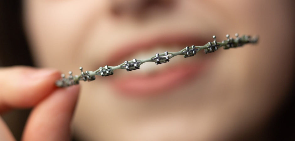 Power Chain Came Off or Broke? | Diamond Braces