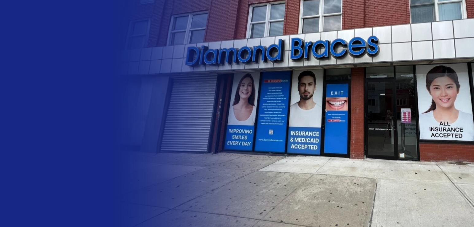Diamond Braces dental office exterior with promotional posters on the facade.