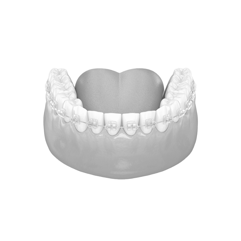 3D asset of ceramic braces on the bottom row of teeth.