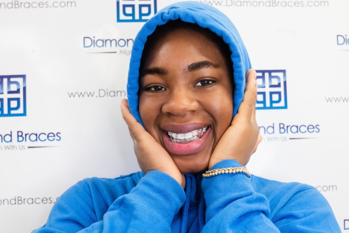 12 Months - Diamond Braces