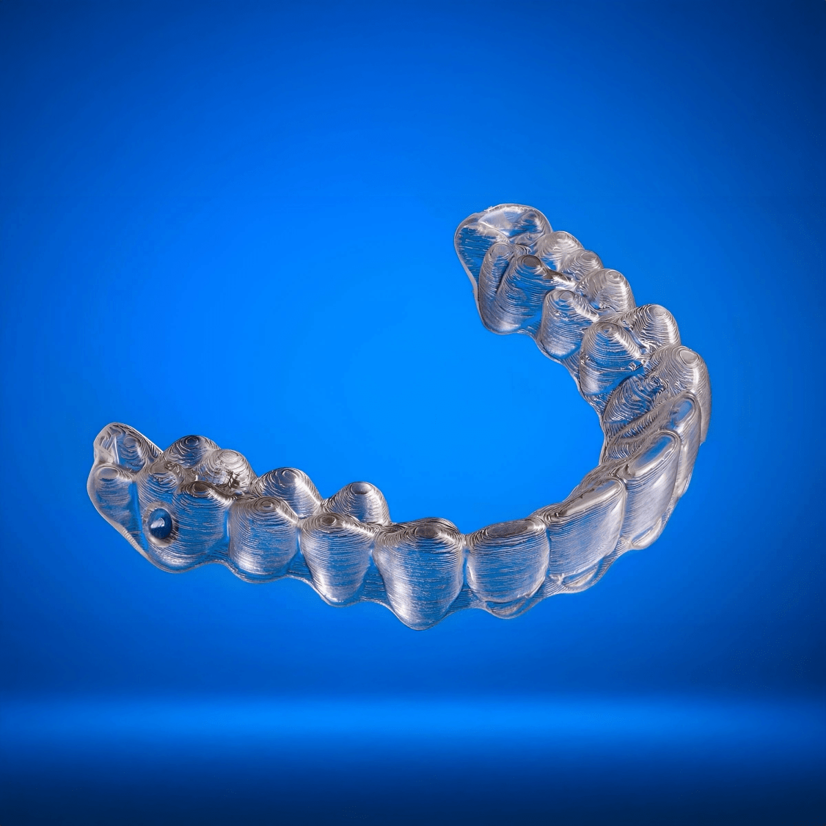 Up to 12 Months - Diamond Braces