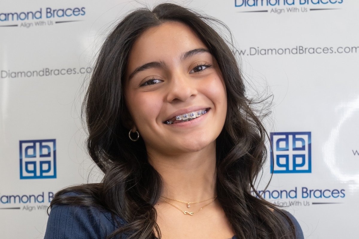 24 Months - Diamond Braces