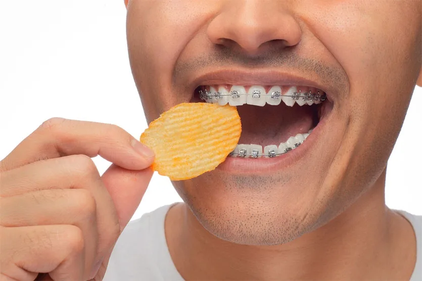 Can You Eat Kettle Chips With Braces: Tips and Cautions